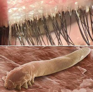 O que é Demodex Folliculorum? | Dermatolaser