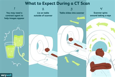 CT (Computed Tomography) Scan: Procedure and Results