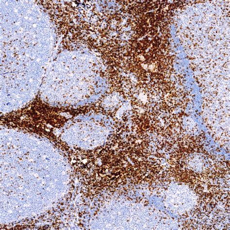 cd ep pathnsitu biotechnologies