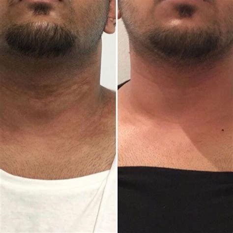 Image Gallery - Derma Revive Skin Clinic