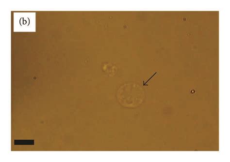 The morphology of the spheroplast W303 cells inside four different ...