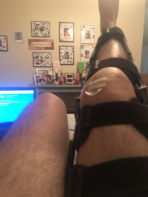 After weeks of physical therapy I can finally lift my leg again | Scrolller