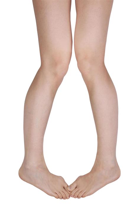 Two legs with aching joints 3512619 Stock Photo at Vecteezy