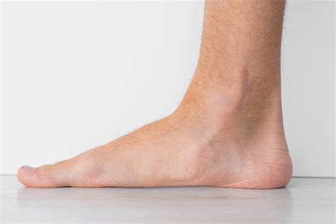 Flat Feet and Overpronation: Shoes & Treatment | Footankleaz