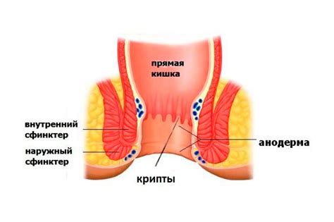Папиллит: причины, симптомы, диагностика и лечение