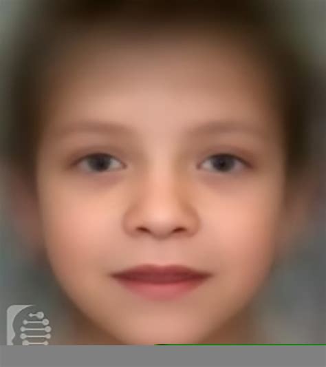 Multiple Lentigines Syndrome