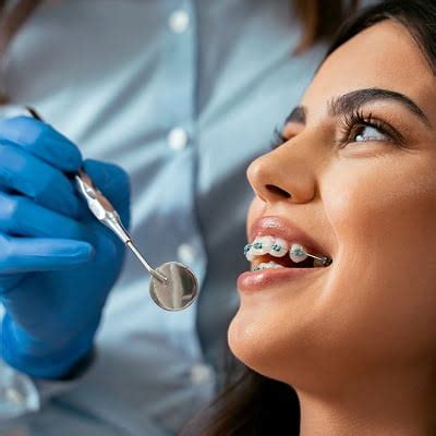 What Are The Pros and Cons of Dental Braces?