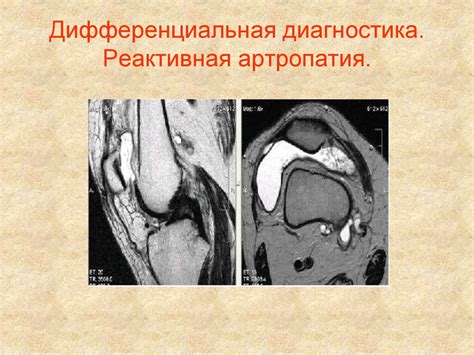 Магнитно-резонансная томография в диагностике ревматоидного артрита на ...