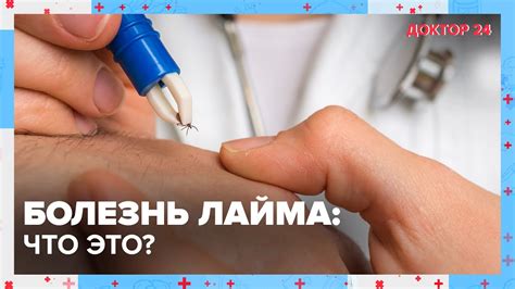 БОЛЕЗНЬ ЛАЙМА: что это? | Доктор 24 - YouTube