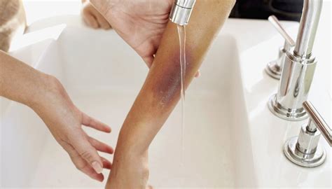 realistic bruising  photoshop synonym