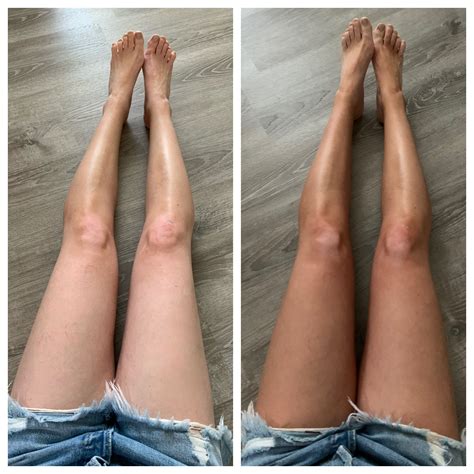 Self Tanning Lotion Before And After at Alan Riggins blog