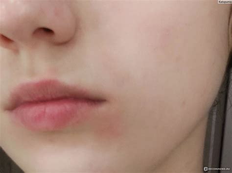 Тонер для лица Orjena "Vitamin C Bright Toner" - «Жуткая реакция на ...