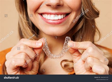 Invisalign Photos and Images & Pictures | Shutterstock