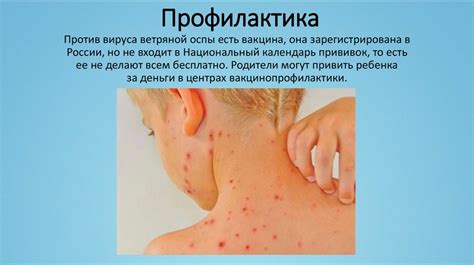 Детские инфекционные заболевания и их профилактика - презентация онлайн