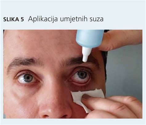 Utjecaj sezonskih alergija na oko - inPharma