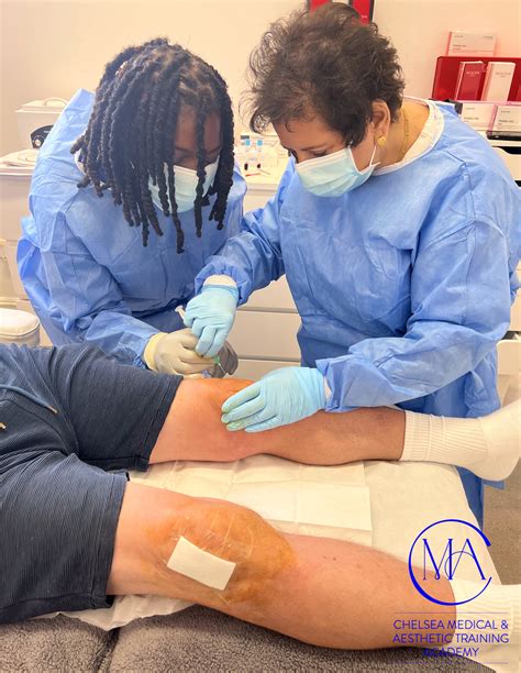 Advanced PRP - Joints - CMA Academy