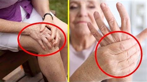 Эта ЦЕЛЕБНАЯ МАЗЬ Вытянет ВСЮ БОЛЬ Из Суставов КОЛЕН, КИСТЕЙ, ЛОКТЕЙ ...