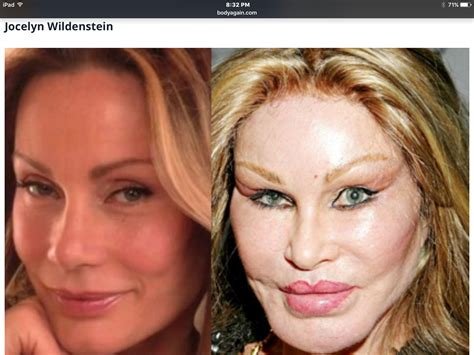 Celebrity Plastic Surgery Celebrity Plastic Surgery Plastic Surgery ...