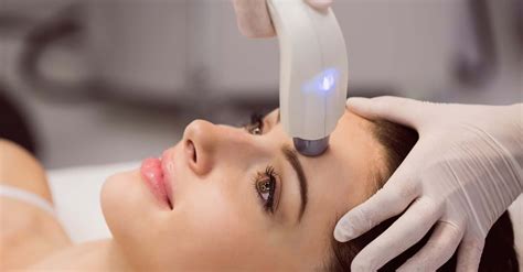 Laser treatments will soon replace traditional black heads removal 16