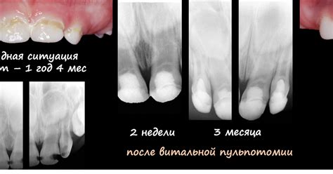 Детская стоматология и ортодонтия в Киеве - блог доктора Пешко Татьяны ...