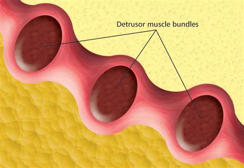 Detrusor Muscle
