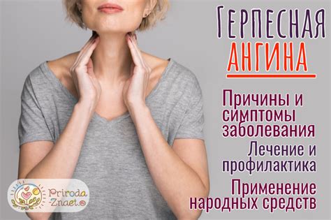 Герпесная ангина: клинические проявления и принцип лечения
