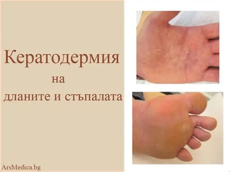 Високи стойности на АСАТ и АЛАТ – причини | ArsMedica.bg