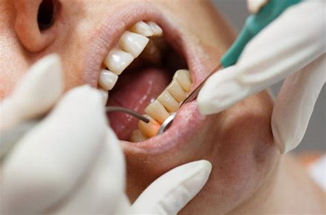 Özel Klinik Denizli İrfan Karababa Ağız ve Diş Sağlığı Polikliniği ...