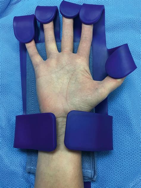 Basic Surgical Technique and Postoperative Care - Clinical Tree