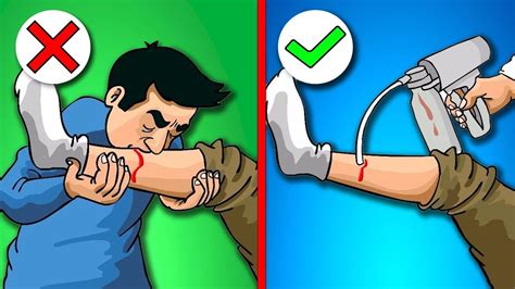 Что Делать, Если Вас Укусили? 10 Советов по Выживанию - YouTube