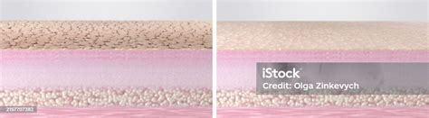 skin dry dead cells exfoliation process  rendered illustration stock