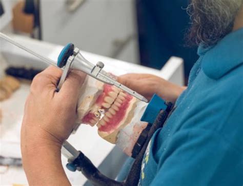 Prepare for Dentures: The Denture Process Start to Finish | European ...