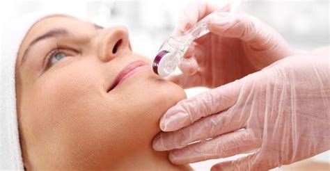 How Long Does It Take to See Results from Micro Needling?