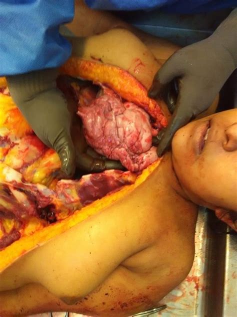 【超！閲覧注意】3人の全裸女性が並べられた。これから何が始まるか（画像あり） - ポッカキット