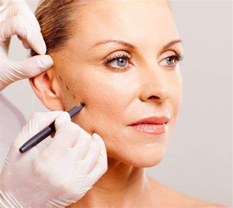 Mini Facelift - Current Facial Plastic Surgery & Medspa