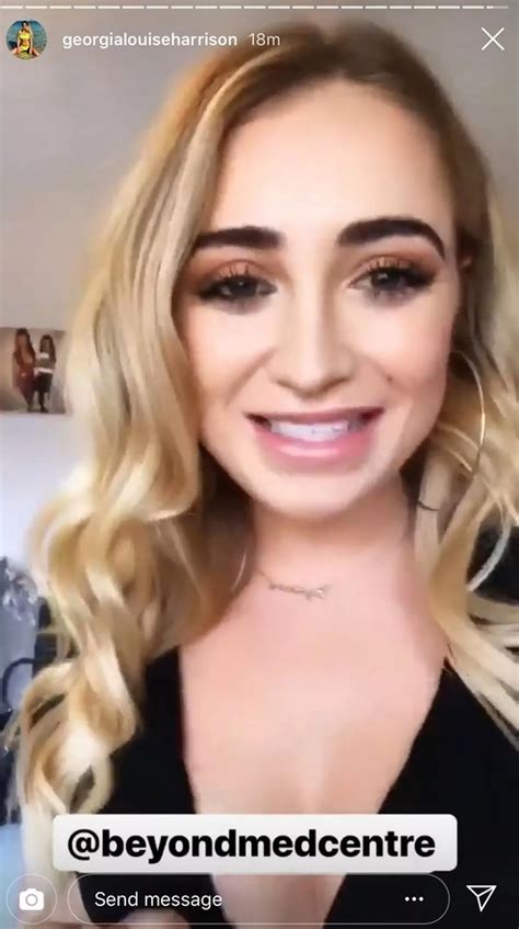 Love Island's Georgia Harrison treats herself to a new CHIN after