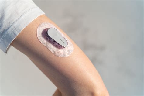 Continuous Glucose Monitoring