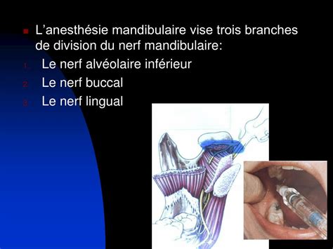 PPT - L’anesthésie locorégionale PowerPoint Presentation, free download