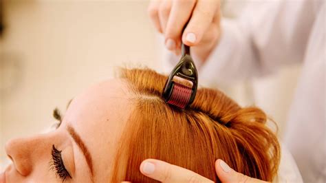 tricologia  terapia capilar renew academy