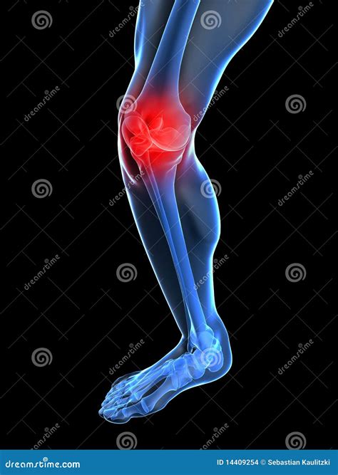 Painful knee illustration stock illustration. Illustration of carcass