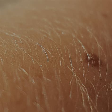 skinimage rcemlearning india