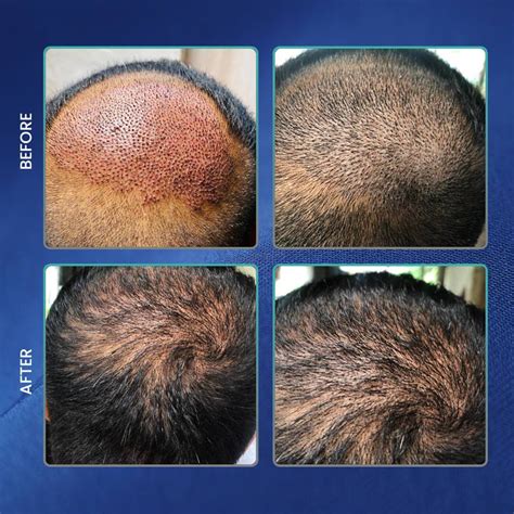 Vitality Hair Clinic - Vitality Hair Clinic
