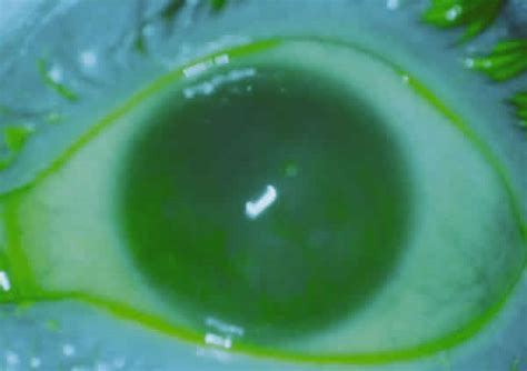 Ciencia de Ifdior: Fluoresceína