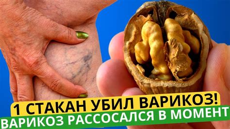 НОГИ НЕ БОЛЯТ, ПЬЮ ЭТО И ПРОШЕЛ ВАРИКОЗ И ПЕРЕСТАЛИ ОПУХАТЬ! Очищает ...