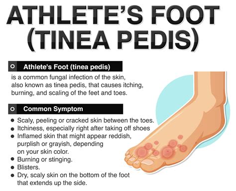 Athlete's foot (tinea pedis) and Diabetes | Viasox