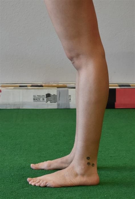 Ehlers Danlos Syndrome – Makovicka Physical Therapy