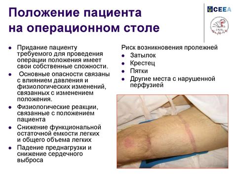 Мониторинг во время анестезии - презентация онлайн