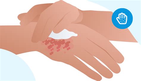 rash cutaneo  sintomi cure doctolib