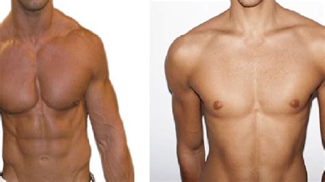 What Are Wide Clavicles at Grace Brentnall blog