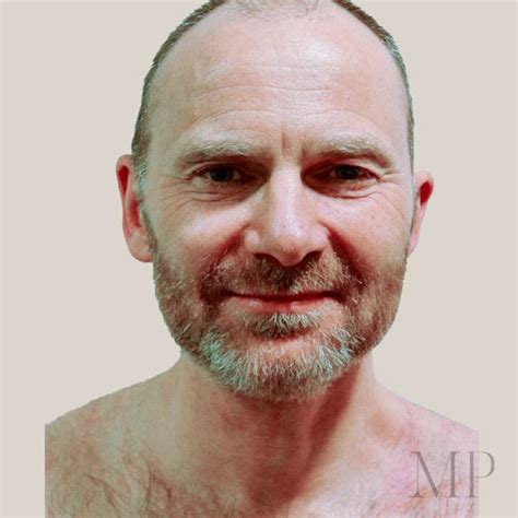 head neck matthew potter